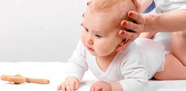 plagiocéphalie bébé