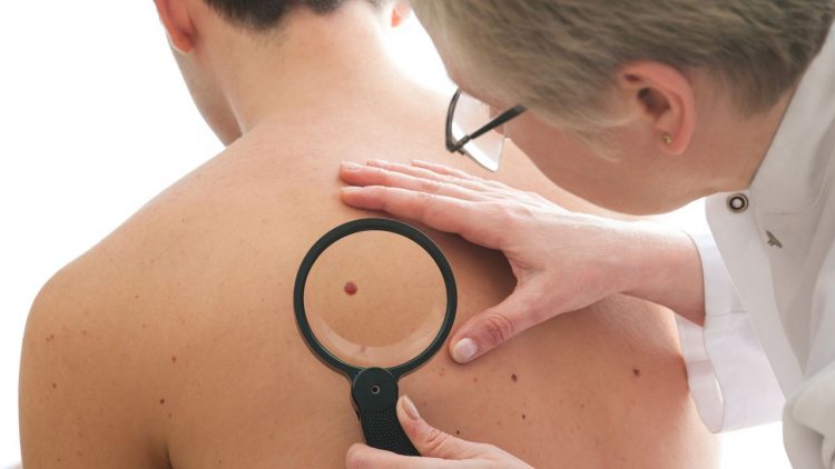Dermatologist examines a mole of male patient