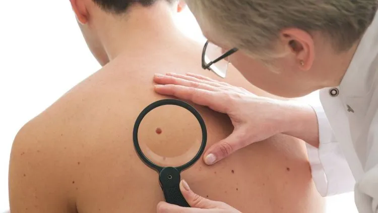 Dermatologist examines a mole of male patient